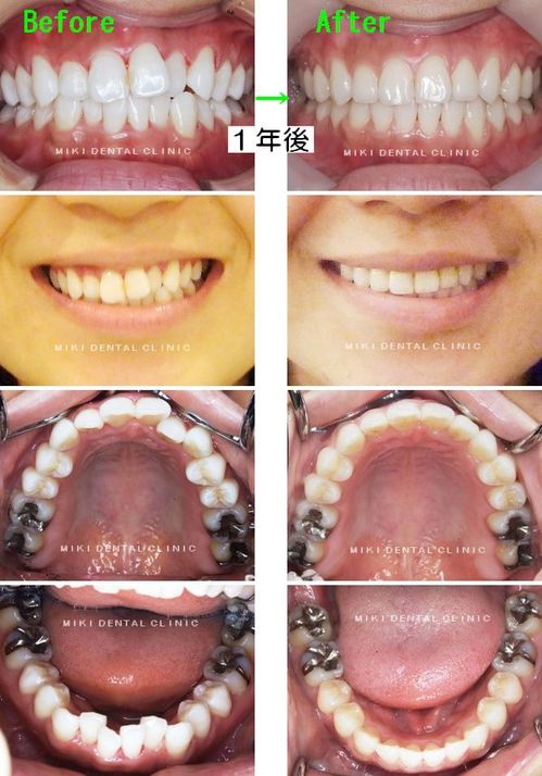 初 終　連結 文字入れ.jpg